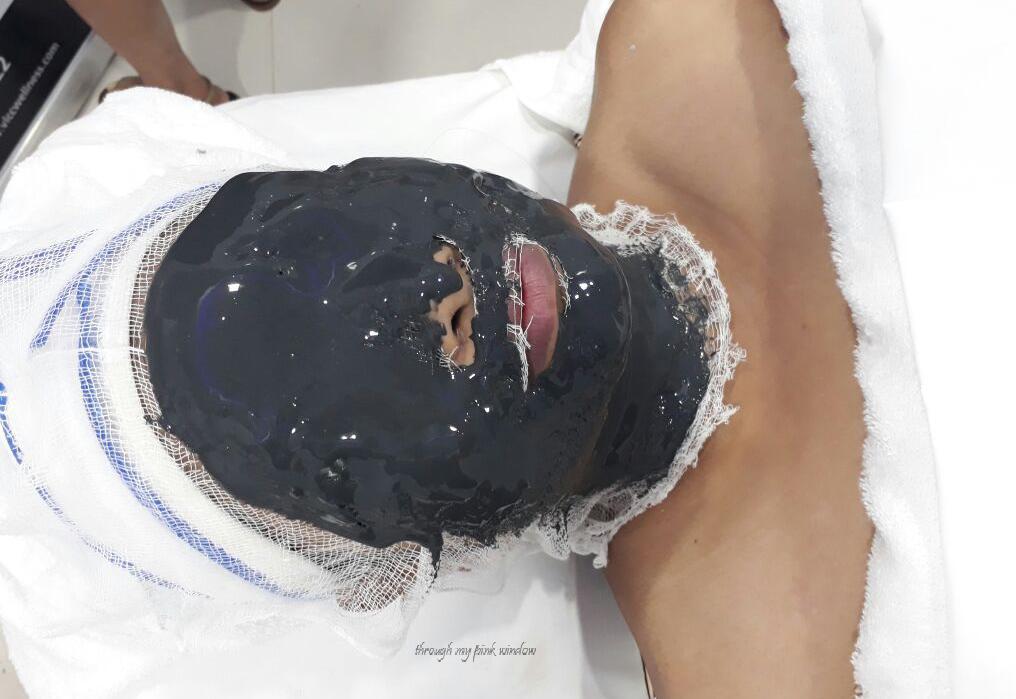 VLCC 7x Ultra Rejuvenating Charcoal Facial